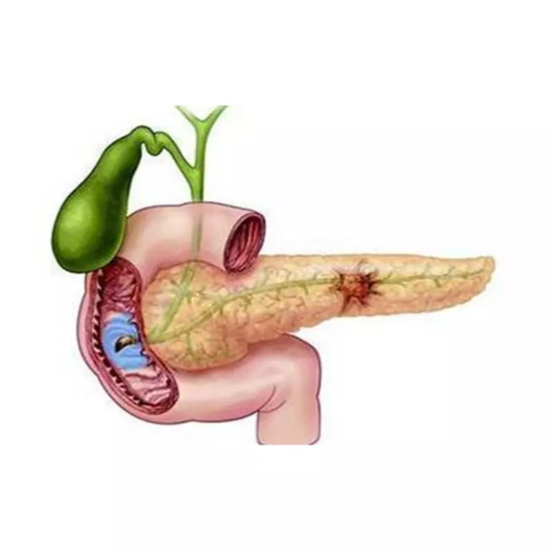 gambar Pancreas Items
