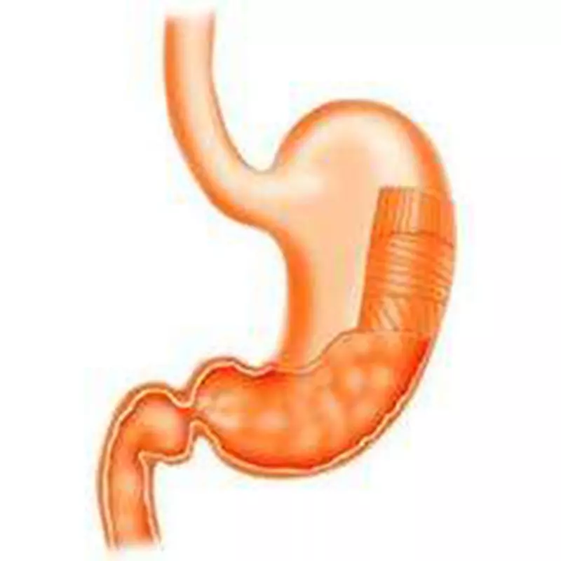 gambar Pepsinogen Items